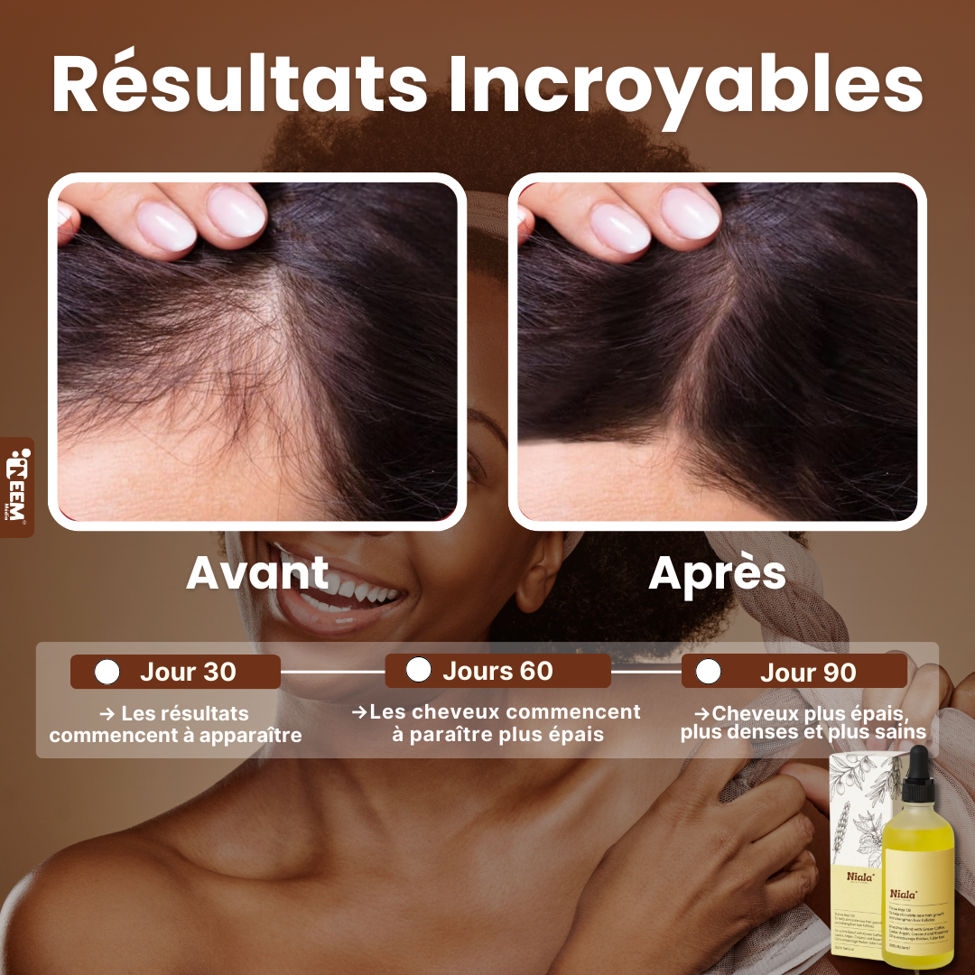 Huile Romarin Pousse Cheuveux